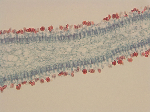 Coprinus Slides - Coprinus 01 400X